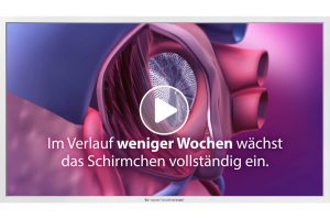 Patientenaufklärungs-Film zum Thema "Vorhofohrverschluss" von TV-Wartezimmer.