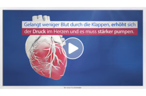 Patientenaufklärungs-Film zum Thema "Aortenstenose" von TV-Wartezimmer.